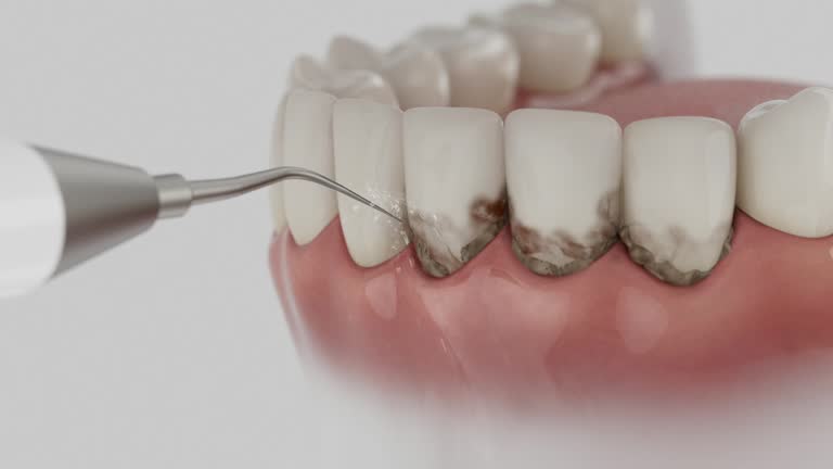 Reliable Dental Implants contractor in Arlington, NE by Smile Center Dentistry